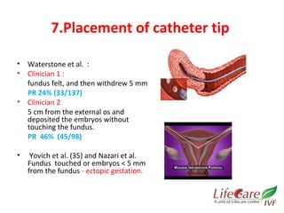7.Placement of catheter tip 
• Waterstone et al. : 
• Clinician 1 : 
fundus felt, and then withdrew 5 mm 
PR 24% (33/137) 
• Clinician 2 
5 cm from the external os and 
deposited the embryos without 
touching the fundus. 
PR 46% (45/98) 
• Yovich et al. (35) and Nazari et al. 
Fundus touched or embryos < 5 mm 
from the fundus - ectopic gestation. 
 