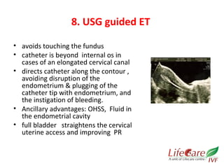8. USG guided ET 
• avoids touching the fundus 
• catheter is beyond internal os in 
cases of an elongated cervical canal 
• directs catheter along the contour , 
avoiding disruption of the 
endometrium & plugging of the 
catheter tip with endometrium, and 
the instigation of bleeding. 
• Ancillary advantages: OHSS, Fluid in 
the endometrial cavity 
• full bladder straightens the cervical 
uterine access and improving PR 
 