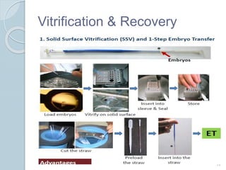 Vitrification & Recovery
19
 