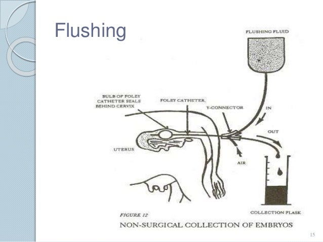 report embryo transfer Embryo transfer, the last step ultrasonic monitoring of embryo transfer was referred to in this report, however, the rank of this factor was not high. report embryo transfer Embryo transfer, the last step ultrasonic monitoring of embryo transfer was referred to in this report, however, the rank of this factor was not high.