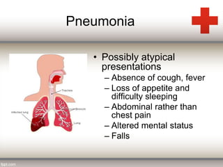 Pneumonia 
• Possibly atypical 
presentations 
– Absence of cough, fever 
– Loss of appetite and 
difficulty sleeping 
– Abdominal rather than 
chest pain 
– Altered mental status 
– Falls 
 