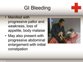 GI Bleeding 
• Manifest with 
progressive pallor and 
weakness, loss of 
appetite, body malaise 
• May also present with 
progressive abdominal 
enlargement with initial 
constipation 
 