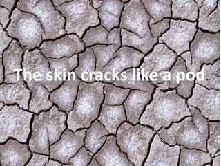 The skin cracks like a pod.
 