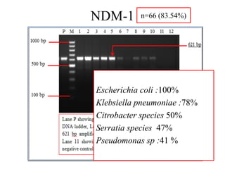Emergence of ndm1 resistance assessment of colistin sparing antibiotic ...