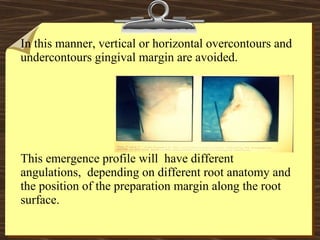 In this manner, vertical or horizontal overcontours and
undercontours gingival margin are avoided.
This emergence profile will have different
angulations, depending on different root anatomy and
the position of the preparation margin along the root
surface.
 