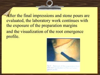 After the final impressions and stone pours are
evaluated, the laboratory work continues with
the exposure of the preparation margins
and the visualization of the root emergence
profile.
 