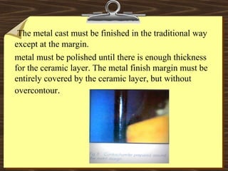 The metal cast must be finished in the traditional way
except at the margin.
metal must be polished until there is enough thickness
for the ceramic layer. The metal finish margin must be
entirely covered by the ceramic layer, but without
overcontour.
 