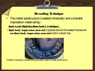 Recording Technique 
• Themetal substructureisseated intraorally and atransfer
impression madeusing:-
dual wash (light/medium body) technique:
- light body impression material (injected around theseated framework
medium body impression material within astock tray
.
Transfer impression incorporating porcelain fused to metal substructure.
 