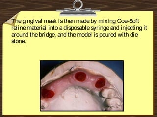 • Thegingival mask isthen madeby mixing Coe-Soft
relinematerial into adisposablesyringeand injecting it
around thebridge, and themodel ispoured with die
stone.
 