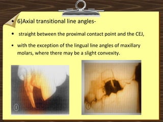 • 6)Axial transitional line angles-
•  straight between the proximal contact point and the CEJ, 
• with the exception of the lingual line angles of maxillary 
molars, where there may be a slight convexity.  
 