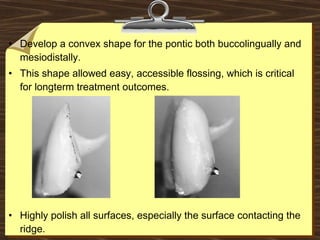 • Develop a convex shape for the pontic both buccolingually and
mesiodistally.
• This shape allowed easy, accessible flossing, which is critical
for longterm treatment outcomes.
• Highly polish all surfaces, especially the surface contacting the
ridge.
 