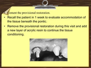 • Cement the provisional restoration.
• Recall the patient in 1 week to evaluate accommodation of
the tissue beneath the pontic.
• Remove the provisional restoration during this visit and add
a new layer of acrylic resin to continue the tissue
conditioning.
 