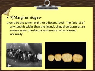 • 7)Marginal ridges- 
should be the same height for adjacent teeth. The facial ½ of 
any tooth is wider than the lingual. Lingual embrasures are 
always larger than buccal embrasures when viewed 
occlusally
 
