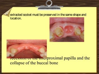 • extracted socket must bepreserved in thesameshapeand
location.
• recession of the interproximal papilla and the
collapse of the buccal bone
 
