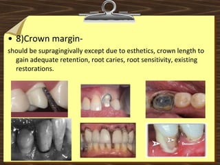 • 8)Crown margin- 
should be supragingivally except due to esthetics, crown length to 
gain adequate retention, root caries, root sensitivity, existing 
restorations.
 