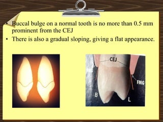 • Buccal bulge on a normal tooth is no more than 0.5 mm
prominent from the CEJ
• There is also a gradual sloping, giving a flat appearance.
 