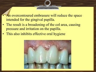 • An overcontoured embrasure will reduce the space
intended for the gingival papilla.
• The result is a broadening of the col area, causing
pressure and irritation on the papilla.
• This also inhibits effective oral hygiene
 