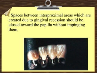 • . Spaces between interproximal areas which are
created due to gingival recession should be
closed toward the papilla without impinging
them.
 