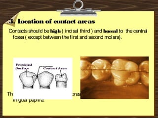 :3. Location of contact areas
Contactsshould behigh( incisal third ) and buccal to thecentral
fossa( except between thefirst and second molars).
Thiscreatesalargelingual embrasurefor optimum health of the
lingual papilla.
 