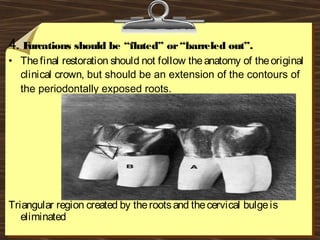 4. Furcations should be “fluted” or“barreled out”.
• Thefinal restoration should not follow theanatomy of theoriginal
clinical crown, but should be an extension of the contours of
the periodontally exposed roots.
Triangular region created by therootsand thecervical bulgeis
eliminated
 