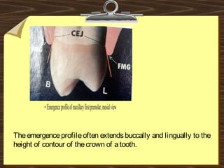 Theemergenceprofileoften extendsbuccally and lingually to the
height of contour of thecrown of atooth.
 