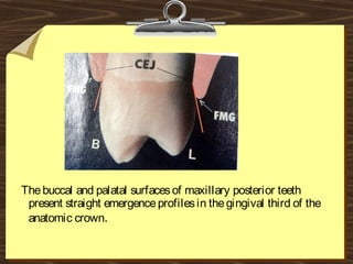 Thebuccal and palatal surfacesof maxillary posterior teeth
present straight emergenceprofilesin thegingival third of the
anatomic crown.
 