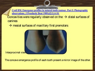 Concavitieswereregularly observed on the:  distal surfacesof
canines
 mesial surfacesof maxillary first premolars
Interproximal view b/n maxillary caninen 1st
premolar.
Theconcaveemergenceprofileof each tooth present amirror imageof theother.
Croll BM. Emergence profiles in natural tooth contour. Part I: Photographic
observations. J Prosthetic Dent 1989;62(1):4-10.
 