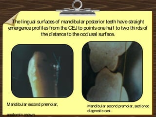 Thelingual surfacesof mandibular posterior teeth havestraight
emergenceprofilesfrom theCEJto pointsonehalf to two thirdsof
thedistanceto theocclusal surface.
Mandibular second premolar,
anatomic crown.
Mandibular second premolar, sectioned
diagnostic cast.
 