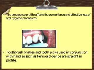 • Theemergenceprofileaffectstheconvenienceand effectivenessof
oral hygieneprocedures.
• Toothbrush bristlesand tooth picksused in conjunction
with handlessuch asPerio-aid devicearestraight in
profile.
 
