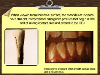 When viewed from thefacial surface, themandibular incisors
havestraight interproximal emergenceprofilesthat begin at the
end of along contact areaand extend to theCEJ
Relationship of natural anterior teeth-contact areas
and gingival tissue.
 