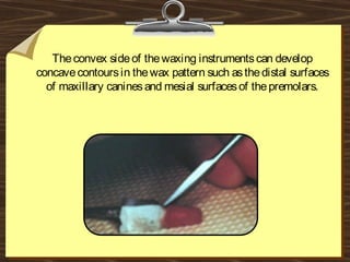 Theconvex sideof thewaxing instrumentscan develop
concavecontoursin thewax pattern such asthedistal surfaces
of maxillary caninesand mesial surfacesof thepremolars.
 
