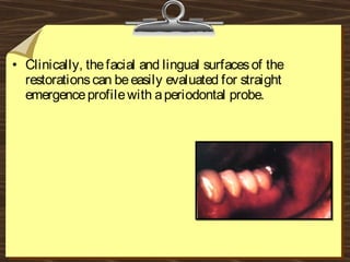 • Clinically, thefacial and lingual surfacesof the
restorationscan beeasily evaluated for straight
emergenceprofilewith aperiodontal probe.
 