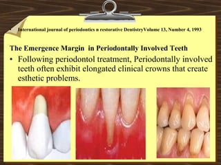 • International journal of periodontics n restorative DentistryVolume 13, Number 4, 1993
The Emergence Margin in Periodontally Involved Teeth
• Following periodontol treatment, Periodontally involved
teeth often exhibit elongated clinical crowns that create
esthetic problems.
 