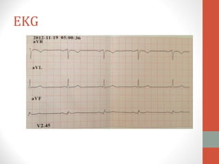 EKG
 