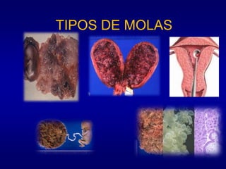 TIPOS DE MOLAS
 
