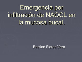 Emergencia porEmergencia por
infiltración de NAOCL eninfiltración de NAOCL en
la mucosa bucal.la mucosa bucal.
Bastian Flores VeraBastian Flores Vera
 
