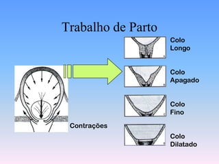 Trabalho de Parto
                    Colo
                    Longo


                    Colo
                    Apagado


                    Colo
                    Fino

 Contrações
                    Colo
                    Dilatado
 