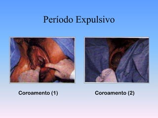 Período Expulsivo




Coroamento (1)      Coroamento (2)
 