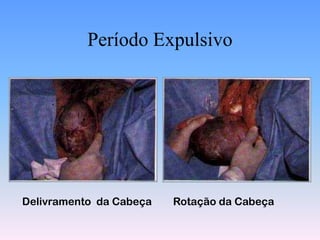 Período Expulsivo




Delivramento da Cabeça   Rotação da Cabeça
 