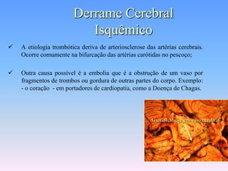 Derrame Cerebral
                           Isquêmico
   A etiologia trombótica deriva de arteriosclerose das artérias cerebrais.
    Ocorre comumente na bifurcação das artérias carótidas no pescoço;

   Outra causa possível é a embolia que é a obstrução de um vaso por
    fragmentos de trombos ou gordura de outras partes do corpo. Exemplo:
    - o coração - em portadores de cardiopatia, como a Doença de Chagas.



                                                       Arteriosclerose em vaso cerebral
 