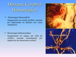 Derrame Cerebral                             Hemorragia intracerebral


     Hemorrágico
 Hemorragia Intracerebral:
  Sangramento no tecido cerebral, causado
  por hipertensão ou defeitos nos vasos
  sanguíneos;


 Hemorragia Subaracnóidea:
  Sangramento no espaço em volta do         Aneurisma cerebral
  cérebro, causado normalmente por
  ruptura de um aneurisma cerebral.
 