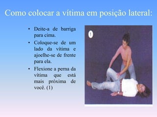 Como colocar a vítima em posição lateral:
      • Deite-a de barriga
        para cima.
      • Coloque-se de um
        lado da vítima e
        ajoelhe-se de frente
        para ela.
      • Flexione a perna da
        vítima que está
        mais próxima de
        você. (1)
 