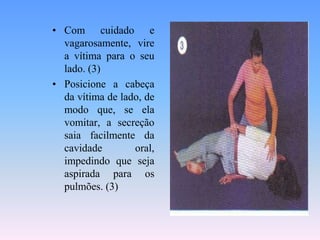 • Com cuidado e
  vagarosamente, vire
  a vítima para o seu
  lado. (3)
• Posicione a cabeça
  da vítima de lado, de
  modo que, se ela
  vomitar, a secreção
  saia facilmente da
  cavidade        oral,
  impedindo que seja
  aspirada para os
  pulmões. (3)
 