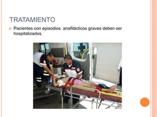 TRATAMIENTO
 Pacientes con episodios anafilácticos graves deben ser
hospitalizados.
 