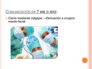 COMUNICACIÓN DE 7 MM O MÁS:
 Cierre mediante colgajos →Derivación a cirujano
maxilo-facial
 