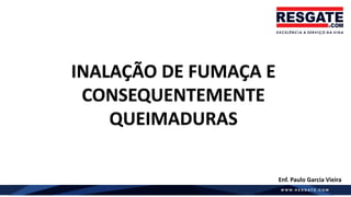 INALAÇÃO DE FUMAÇA E
CONSEQUENTEMENTE
QUEIMADURAS
Enf. Paulo Garcia Vieira
 