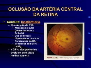 OCLUSÃO DA ARTÉRIA CENTRAL
DA RETINA
• Conduta: Insatisfatória
– Diminuição da PIO:
• Massagem ocular
(tentar deslocar o
êmbolo)
• Uso de drogas
hipotensoras oculares
• Paracentese da CA
• Ventilação com 95 %
de O2
– ± 35 % dos pacientes
evoluem com visão
melhor que 0,2
 