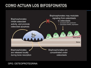 OPG: OSTEOPROTEGRINA 