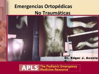 Emergencias Ortopédicas
       No Traumáticas




                   Dr. Edgar J. Acosta
                   C.
 
