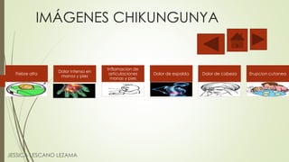 IMÁGENES CHIKUNGUNYA
JESSICA LESCANO LEZAMA
Fiebre alta
Dolor intenso en
manos y pies
Inflamacion de
articulaciones
manos y pies
Dolor de espalda Dolor de cabeza Erupcion cutanea
 